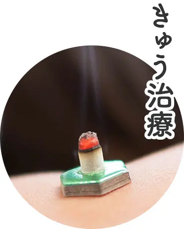 きゅう治療